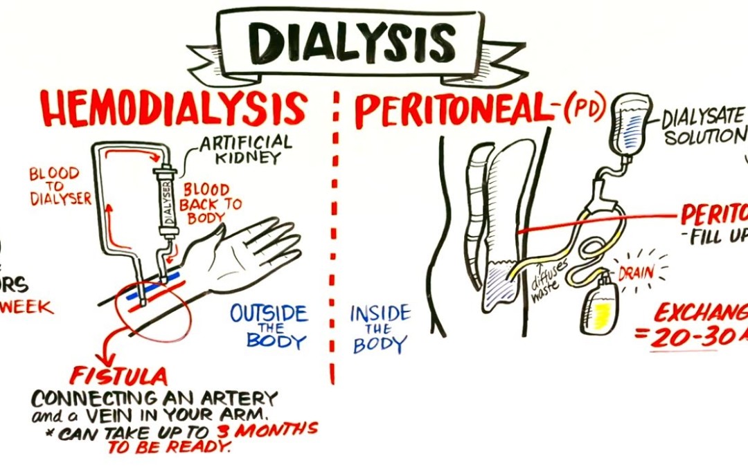 How Hemodialysis and Peritoneal Dialysis Work