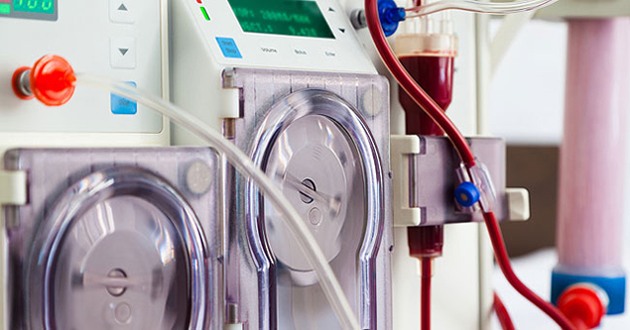 The Hemodialysis Process - United Dialysis Center